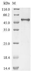 Human Inter-alpha-trypsin inhibitor heavy chain H3 (ITIH3), partial Recombinant Protein, Homo sapiens (Human), E.coli, N-terminal 10xHis-GST-tagged and C-terminal Myc-tagged, 51.2 kDa, purity >≥ 85% as determined by SDS-PAGE.