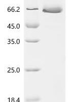 Human TSH alpha/beta Heterodimer Protein Recombinant Protein - BioCrest Sci