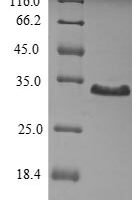Human Thrombopoietin (THPO)，partial Recombinant Protein - BioCrest Sci