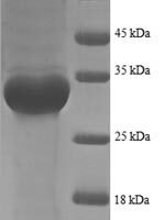 Escherichia coli 50S ribosomal protein L35 (rpmI), partial Recombinant Protein - BioCrest Sci