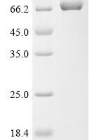 Newcastle disease virus Hemagglutinin-neuraminidase (HN), partial Recombinant Protein, N-His - BioCrest Sci