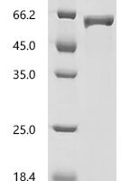 Human Nucleosome assembly protein 1-like 1 (NAP1L1) Recombinant Protein, C-His, aa 2–388, E.coli - BioCrest Sci