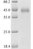 Candida albicans chitin deacetylase (CDA2) Recombinant Protein - BioCrest Sci