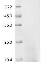 Escherichia coli O6:H1 DNA-binding protein HU-alpha (hupA) Recombinant Protein - BioCrest Sci