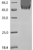 Human R3H domain-containing protein 2 (R3HDM2), partial Recombinant Protein, N-His-SUMOstar - BioCrest Sci