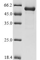 Coxsackievirus B3 Genome polyprotein, partial Recombinant Protein - BioCrest Sci