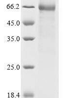Saguinus oedipus Kallikrein-15 (KLK15) Recombinant Protein - BioCrest Sci