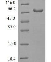 Human  Receptor-interacting serine/threonine-protein kinase 3 (RIPK3) Recombinant Protein - BioCrest Sci