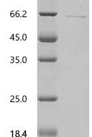 Mouse Antiviral innate immune response effector IFIT1 (Ifit1) Recombinant Protein - BioCrest Sci