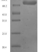 Human Glutaminase liver isoform, mitochondrial (GLS2) Recombinant Protein - BioCrest Sci