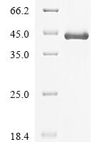 Rat CCN family member 1 (Ccn1) Recombinant Protein - BioCrest Sci