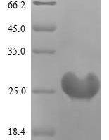 Human Oncostatin-M (OSM), partial Recombinant Protein, C-His - BioCrest Sci