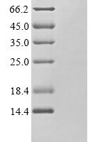 Human Calcitonin (CALCA) Recombinant Protein - BioCrest Sci