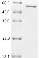 Human Collagen alpha-2(IV) chain (COL4A2), partial Recombinant Protein - BioCrest Sci
