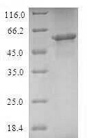 Human Mitochondrial import receptor subunit TOM40 homolog (TOMM40) Recombinant Protein - BioCrest Sci