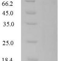 Human Replication factor C subunit 1 (RFC1), partial Recombinant Protein, N-His - BioCrest Sci