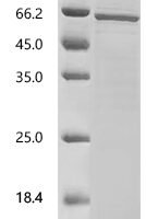 Mouse Serine/threonine-protein phosphatase 2B catalytic subunit beta isoform(Ppp3cb) Recombinant Protein - BioCrest Sci