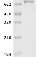 Human G1/S-specific cyclin-D1 (CCND1), Biotinylated Recombinant Protein - BioCrest Sci