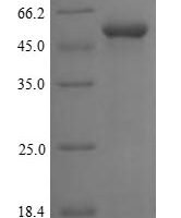 Human F-box/LRR-repeat protein 2 (FBXL2) Recombinant Protein, N-His - BioCrest Sci