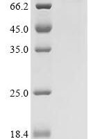 Human Long-chain-fatty-acid--CoA ligase 4 (ACSL4), partial Recombinant Protein - BioCrest Sci