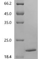 Human SH3 and multiple ankyrin repeat domains protein 3 (SHANK3), partial Recombinant Protein, C-His - BioCrest Sci