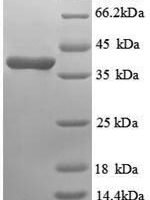 Human Annexin A3 (ANXA3), partial Recombinant Protein, N-His, aa 5–322, E.coli - BioCrest Sci
