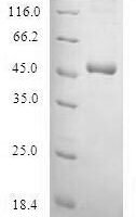 Human Protein SSX4 (SSX4) Recombinant Protein - BioCrest Sci