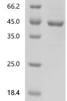 Escherichia coli O157:H7 Hydrogenase 3 maturation protease (hycI) Recombinant Protein, N-His-GST - BioCrest Sci