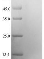 Human mRNA-decapping enzyme 1A (DCP1A) Recombinant Protein - BioCrest Sci
