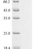Mouse Beta-adrenergic receptor kinase 2 (Adrbk2) Recombinant Protein - BioCrest Sci