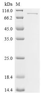 Mouse Beta-adrenergic receptor kinase 2 (Adrbk2) Recombinant Protein, Mus musculus (Mouse), E.coli, N-terminal 10xHis-tagged and C-terminal Myc-tagged, 87.1 kDa, purity >≥ 95% as determined by SDS-PAGE.