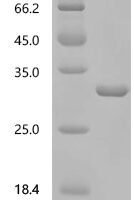 Human immunodeficiency virus type 1 group M subtype B Gag polyprotein (gag), partial Recombinant Protein, C-His, aa 133–363, E.coli - BioCrest Sci