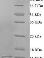 Pinctada fucata N16.1 matrix protein Recombinant Protein, N-His - BioCrest Sci