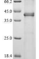 Human PHD finger protein 6 (PHF6) Recombinant Protein - BioCrest Sci