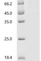 Human Neurogenin-2 (NEUROG2) Recombinant Protein - BioCrest Sci