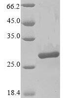 Human Protein mono-ADP-ribosyltransferase PARP14 (PARP14), partial Recombinant Protein, N-10His/C-Myc, aa 1605–1801, Yeast - BioCrest Sci