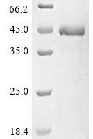 Human T-cell immunoglobulin and mucin domain-containing protein 4 (TIMD4), partial Recombinant Protein - BioCrest Sci
