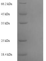 Crocodylus niloticus Histone H2B Recombinant Protein - BioCrest Sci