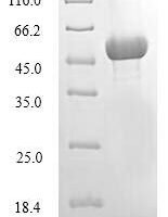 Candida glabrata Serine/threonine-protein kinase ATG1 (ATG1), partial Recombinant Protein, N-His - BioCrest Sci