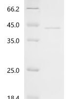Vespula vulgaris Phospholipase A1 Recombinant Protein, C-His - BioCrest Sci