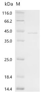 Vespula vulgaris Phospholipase A1 Recombinant Protein, C-His, Vespula vulgaris (Yellow jacket) (Wasp), E.coli, C-terminal 6xHis-tagged, 40.3 kDa, purity >≥ 90% as determined by SDS-PAGE.