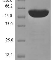 Human Protein disulfide-isomerase A3 (PDIA3) Recombinant Protein - BioCrest Sci