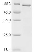 Human Protein boule-like (BOLL) Recombinant Protein, N-His-GST - BioCrest Sci