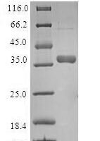 Human Mitochondrial import inner membrane translocase subunit Tim8 A (TIMM8A) Recombinant Protein - BioCrest Sci