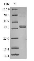 Human Mitochondrial import inner membrane translocase subunit Tim8 A (TIMM8A) Recombinant Protein, Homo sapiens (Human), E.coli, N-terminal GST-tagged, 38.0 kDa, purity >≥ 90% as determined by SDS-PAGE.