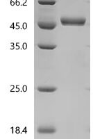 Rat Interleukin-2 (Il2) Recombinant Protein, C-hFc1 - BioCrest Sci