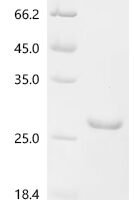 Mouse Interleukin-36 gamma (Il36g), partial Recombinant Protein - BioCrest Sci