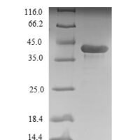 Rat Ribosyldihydronicotinamide dehydrogenase [quinone] (Nqo2) Recombinant Protein - BioCrest Sci