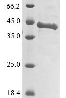 Human Agouti-signaling protein (ASIP), partial Recombinant Protein - BioCrest Sci