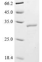 Human CCR4-NOT transcription complex subunit 7 (CNOT7) Recombinant Protein, C-His - BioCrest Sci